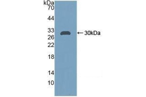 CA2 antibody  (AA 1-260)