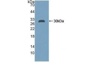 Detection of Recombinant CA2, Rat using Polyclonal Antibody to Carbonic Anhydrase II (CA2) (CA2 antibody  (AA 1-260))