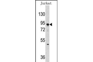 Western blot analysis of anti-DNMT3A Antibody (Center ) (ABIN387882 and ABIN2844093) in Jurkat cell line lysates (35 μg/lane). (DNMT3A antibody  (AA 457-486))