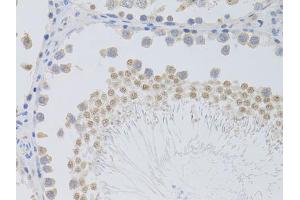 Immunohistochemistry of paraffin-embedded rat testis using PHC1 antibody (ABIN5973455) at dilution of 1/100 (40x lens). (PHC1 antibody)