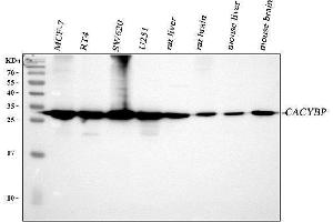 Western blot analysis of CACYBP using anti-CACYBP antibody (ABIN4886495). (CACYBP antibody  (N-Term))