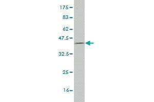 Western Blot detection against Immunogen (36. (PFKL antibody  (AA 441-540))