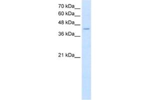 Western Blotting (WB) image for anti-Fatty Acid Desaturase 1 (FADS1) antibody (ABIN2462576) (FADS1 antibody)