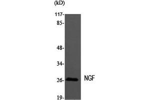 Western Blot analysis of MEF1 cells using NGF Polyclonal Antibody at dilution of 1:2000. (Nerve Growth Factor antibody)