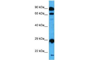 Host:  Mouse  Target Name:  MED6  Sample Tissue:  Mouse Testis  Antibody Dilution:  1ug/ml (MED6 antibody  (Middle Region))