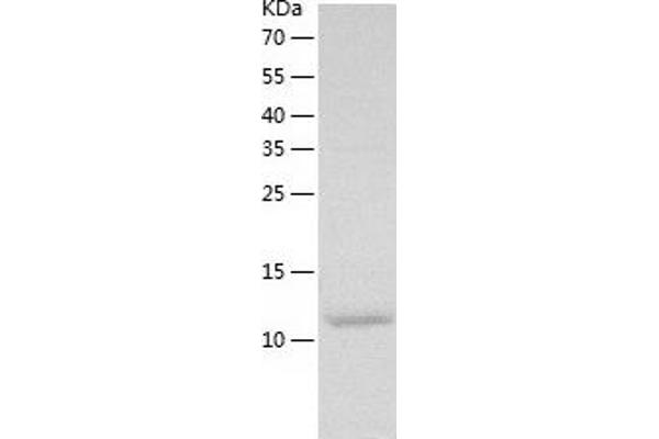 CCL28 Protein (AA 20-135) (His tag)