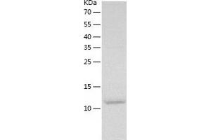 Western Blotting (WB) image for Chemokine (C-C Motif) Ligand 28 (CCL28) (AA 20-135) protein (His tag) (ABIN7288165) (CCL28 Protein (AA 20-135) (His tag))