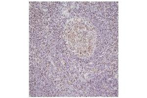 Immunohistochemistry This image shows paraffin-embedded human palatine tonsil tissue sample stained with anti-NPM antibody(5E3) at 1:100 dilution. (NPM1 antibody)