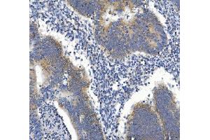 IHC analysis of GDF8/Myostatin/MSTN using anti-GDF8/Myostatin/MSTN antibody (ABIN7602824). (MSTN antibody  (C-Term))