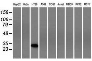 Image no. 2 for anti-Four and A Half LIM Domains 1 (FHL1) antibody (ABIN1500976) (FHL1 antibody)