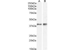 ABIN238549 (0. (IL12B antibody  (Internal Region))