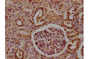 IHC image of ABIN7148399 diluted at 1:100 and staining in paraffin-embedded human kidney tissue performed on a Leica BondTM system. (CFHR5 antibody  (AA 374-569))