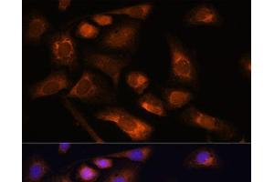 Immunofluorescence analysis of U-2 OS cells using RPS13 Polyclonal Antibody at dilution of 1:100. (RPS13 antibody)