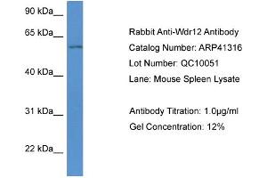 Western Blotting (WB) image for anti-WD Repeat Domain 12 (WDR12) (Middle Region) antibody (ABIN785151) (WDR12 antibody  (Middle Region))