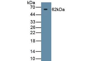 Detection of Recombinant HSPD1, Human using Monoclonal Antibody to Heat Shock Protein 60 (Hsp60) (HSPD1 antibody  (AA 1-573))