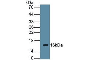 Figure Western Blot Sample: Recombinant DRD1, Rat (Dopamine Receptor d1 antibody  (AA 338-446))