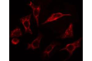 ABIN6267393 staining Hela cells by IF/ICC. (VAV1 antibody  (pTyr174))