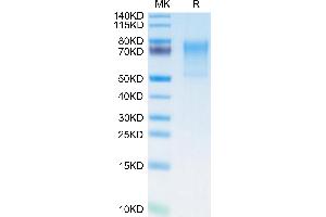 Human ECSCR on Tris-Bis PAGE under reduced condition.