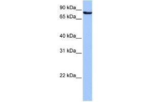 Ubiquilin 3 antibody used at 1 ug/ml to detect target protein. (Ubiquilin 3 antibody  (N-Term))