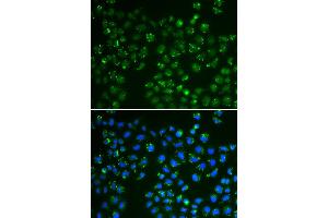 Immunofluorescence analysis of A549 cells using GPX4 antibody (ABIN6294188). (GPX4 antibody)