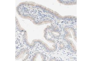 Immunohistochemical staining of human gallbladder with MANEA polyclonal antibody  shows moderate cytoplasmic positivity, with a granular pattern, in glandular cells.