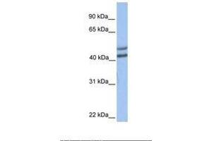 Image no. 1 for anti-Galactose-1-Phosphate Uridylyltransferase (GALT) (C-Term) antibody (ABIN6738465) (GALT antibody  (C-Term))