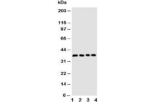 Western blot testing of CD1d antibody and Lane 1:  COLO320;  2: HeLa;  3: HT1080;  4: Jurkat cell lysate