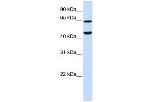 TRIM54 antibody used at 1 ug/ml to detect target protein.
