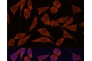 Immunofluorescence analysis of L929 cells using TRAPPC6A Polyclonal Antibody at dilution of 1:100. (TRAPPC6A antibody)