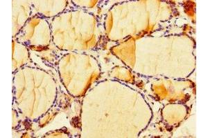 Immunohistochemistry of paraffin-embedded human thyroid tissue using ABIN7147797 at dilution of 1:100 (CIART (AA 1-385) antibody)