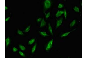 Immunofluorescent analysis of U251 cells using ABIN7168545 at dilution of 1:100 and Alexa Fluor 488-congugated AffiniPure Goat Anti-Rabbit IgG(H+L) (MTAP antibody  (AA 1-283))