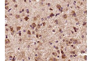 Paraformaldehyde-fixed, paraffin embedded mouse brain, Antigen retrieval by boiling in sodium citrate buffer (pH6) for 15min, Block endogenous peroxidase by 3% hydrogen peroxide for 30 minutes, Blocking buffer (normal goat serum) at 37°C for 20min, Antibody incubation with DCTN3 Polyclonal Antibody at 1:400 overnight at 4°C, followed by a conjugated secondary and DAB staining (DCTN3 antibody  (AA 41-150))