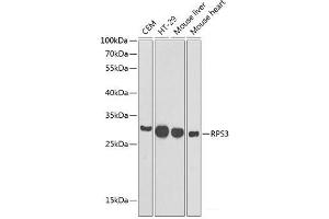 Western blot analysis of extracts of various cell lines using RPS3 Polyclonal Antibody at dilution of 1:1000. (RPS3 antibody)