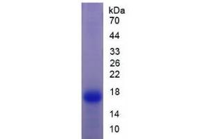 SDS-PAGE analysis of Rat Transthyretin Protein. (TTR Protein)