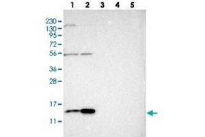 Western blot analysis of Lane 1: RT-4, Lane 2: U-251 MG, Lane 3: Human Plasma, Lane 4: Liver, Lane 5: Tonsil with SLIRP polyclonal antibody  at 1:250-1:500 dilution.
