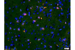 Formalin-fixed and paraffin-embedded rat brain labeled with Anti-IGFBP3 Polyclonal Antibody, Unconjugated (ABIN686497) 1:200, overnight at 4°C, The secondary antibody was Goat Anti-Rabbit IgG,Cy3 conjugated used at 1:200 dilution for 40 minutes at 37°C. (IGFBP3 antibody  (AA 186-292))