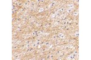 Immunohistochemical staining of human brain tissue using AP30032PU-N AIFM3 antibody at 2. (AIFM3 antibody  (N-Term))
