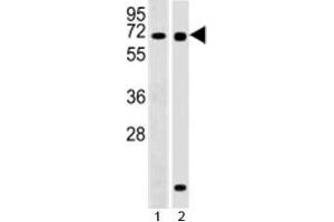Western blot testing of RBPJ antibody at 1:2000 dilution and 1) Ramos, 2) human pancreas lysate; Predicted molecular weight ~ 56 kDa. (RBPJ antibody  (AA 1-29))