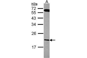 AP31125PU-N RGS10 antibody staining of A431 (Lane A) whole cell lysate (30 µg) at 1/1000 dilution, 12% SDS PAGE. (RGS10 antibody  (AA 1-160))