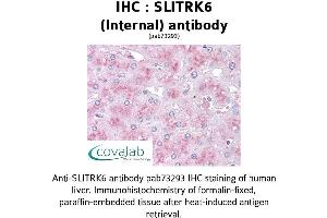 Image no. 1 for anti-SLIT and NTRK-Like Family, Member 6 (SLITRK6) (Internal Region) antibody (ABIN1739441) (SLITRK6 antibody  (Internal Region))