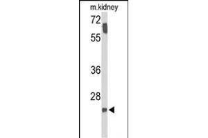 Western blot analysis of SMNDC1 Antibody (N-term) (ABIN653319 and ABIN2842811) in mouse kidney tissue lysates (35 μg/lane). (SMNDC1 antibody  (N-Term))