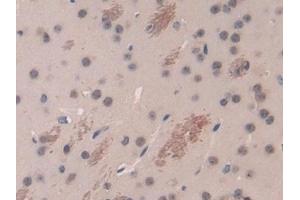 Detection of DARC in Mouse Cerebrum Tissue using Polyclonal Antibody to Duffy Blood Group Chemokine Receptor (DARC) (DARC antibody  (AA 71-330))