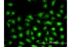 Immunofluorescence of monoclonal antibody to UBE2L3 on HeLa cell. (UBE2L3 antibody  (AA 1-154))