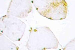 Immunohistochemistry (IHC) analyzes of UDG antibody in paraffin-embedded human skeletal muscle tissue. (Cyclin O antibody)