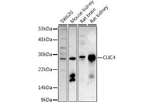 Western blot analysis of extracts of various cell lines, using CLIC4 antibody (ABIN6127638, ABIN6138723, ABIN6138724 and ABIN6222890) at 1:500 dilution.