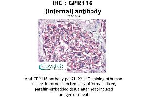 Image no. 1 for anti-G Protein-Coupled Receptor 116 (GPR116) (Internal Region) antibody (ABIN1734908)