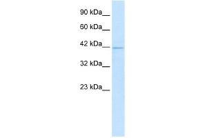 WB Suggested Anti-HOXA10 Antibody Titration:  1. (HOXA10 antibody  (N-Term))