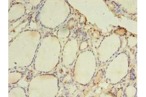 Immunohistochemistry of paraffin-embedded human thyroid tissue using ABIN7172278 at dilution of 1:100 (TLR6 antibody  (AA 32-586))