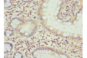 Immunohistochemistry of paraffin-embedded human small intestine tissue using ABIN7152794 at dilution of 1:100 (FGF19 antibody  (AA 25-216))