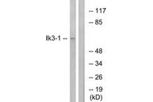 Western blot analysis of extracts from LOVO cells, using Ik3-1 Antibody.